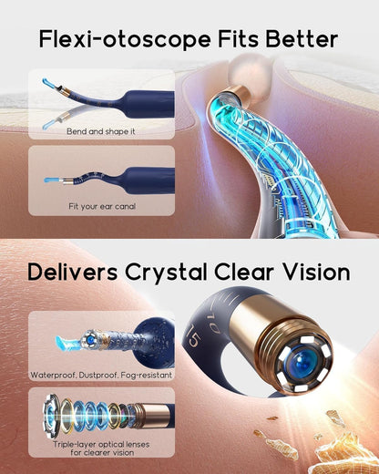 SELLASTIC Ear Cleaner Tool Kit, Ear Wax Removal with HD Camera & WiFi Connection, Flexible Otoscope Camera Light for iOS & Android, Safe Ear Cleaning for Adults & Baby - 1 Year Warranty
