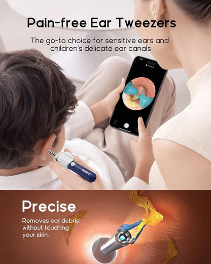 SELLASTIC Ear Cleaner Tool Kit, Ear Wax Removal with HD Camera & WiFi Connection, Flexible Otoscope Camera Light for iOS & Android, Safe Ear Cleaning for Adults & Baby - 1 Year Warranty
